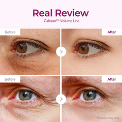 Dr.Melaxin Calcium Volume Eye Patch 60 patches